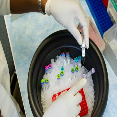 Postgrado en Técnicas y Métodos de Laboratorio Clínico + Titulación Universitaria