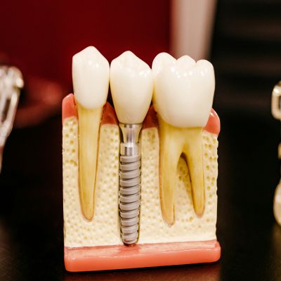 Máster en Odontología Estética