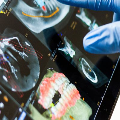 MÁSTER EN ODONTOLOGÍA ESTÉTICA Online, Semipresencial