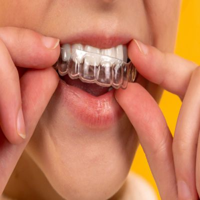 MASTER EN TÉCNICAS AUXILIARES DE ODONTOLOGÍA A Distancia, Online, Semipresencial